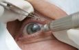 Cirurgia que altera cor do olho tem uso restrito para pessoas cegas