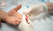 Casos de hepatites virais caem 24% no RN, mas hepatite C segue como a mais comum