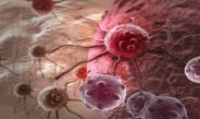 Conheça terapia desenvolvida no Brasil com células CAR-T para tratar linfoma não Hodgkin