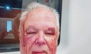 Militante idoso do PT é agredido por bolsonaristas por usar adesivo de Benedita da Silva