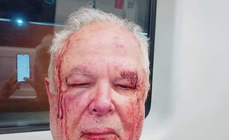 Militante idoso do PT é agredido por bolsonaristas por usar adesivo de Benedita da Silva